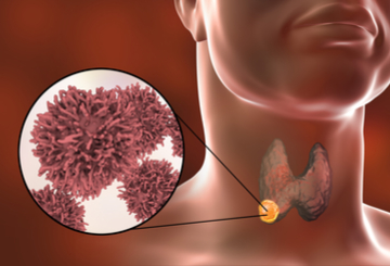 2019年欧洲肿瘤内科学会乳腺癌会议（ESMO-Breast）