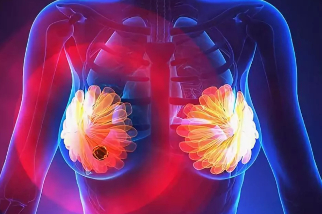 嘉和生物|潜力CDK4/6新药GB491一线临床试验快速实现首例乳腺癌患者入组