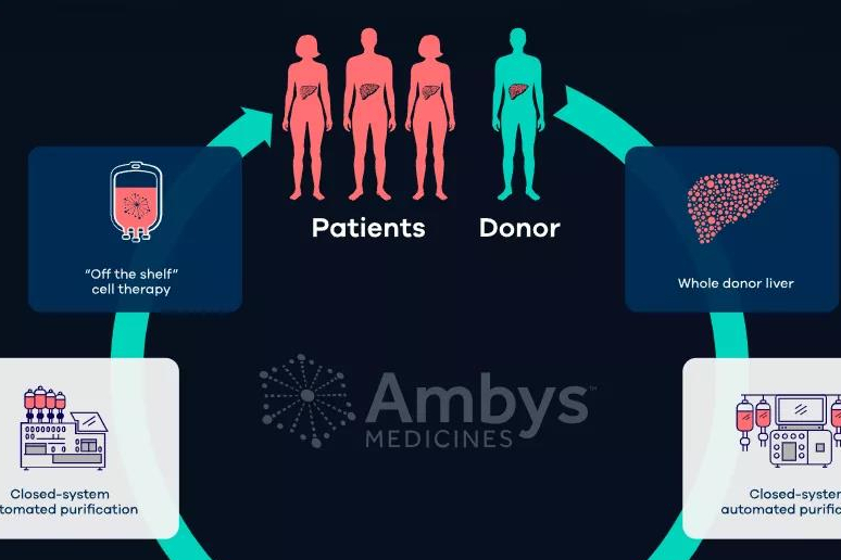 Ambys 推进肝细胞治疗平台，完成4700万美元A+轮融资