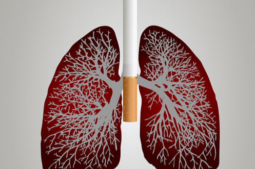 中国肺癌靶向治疗：EGFR靶点分析！可显著提高患者生存期