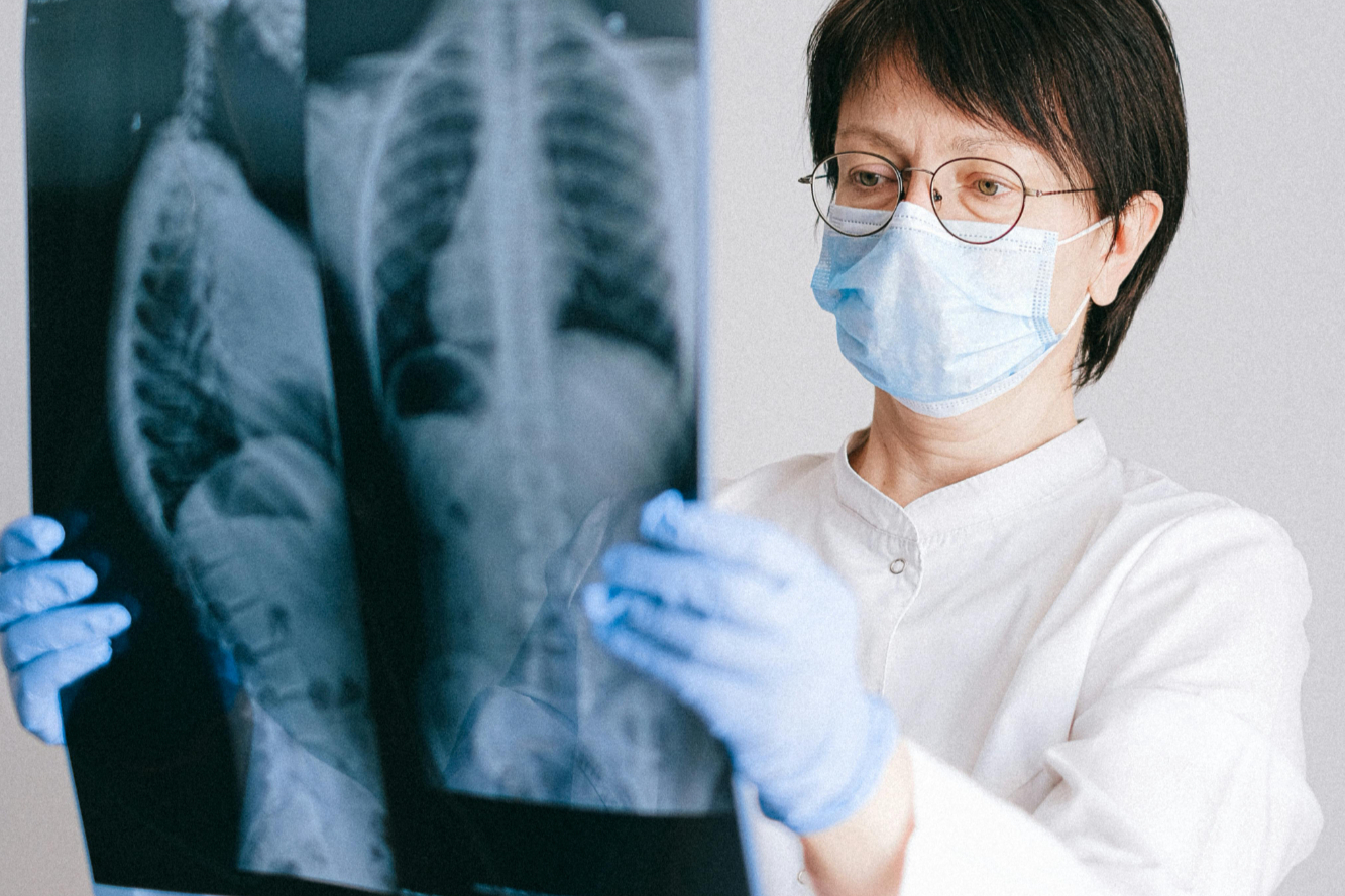 2024年非小细胞肺癌（NSCLC）流行病学、治疗进展与市场趋势分析